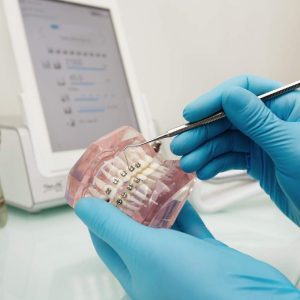 dentist-holding-dental-plastic-model-with-braces